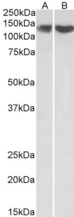 Invitrogen REST Polyclonal Antibody 100 &mu;g; Unconjugated:Antibodies,