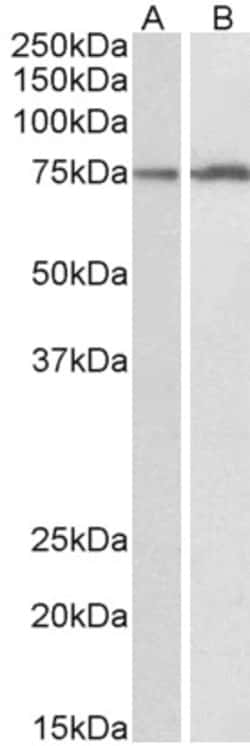 Invitrogen CYP2B6 Polyclonal Antibody 100 &mu;g | Buy Online | Invitrogen&trade; | Fisher Scientific