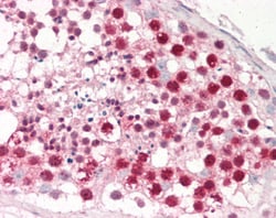 Invitrogen DUT Polyclonal Antibody 100 &mu;g; Unconjugated:Antibodies,