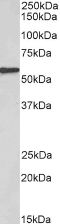 Invitrogen EPHX2 Polyclonal Antibody 100 &mu;g; Unconjugated:Antibodies,