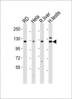 Invitrogen Vinculin Polyclonal Antibody 400 &mu;L; Unconjugated:Antibodies,