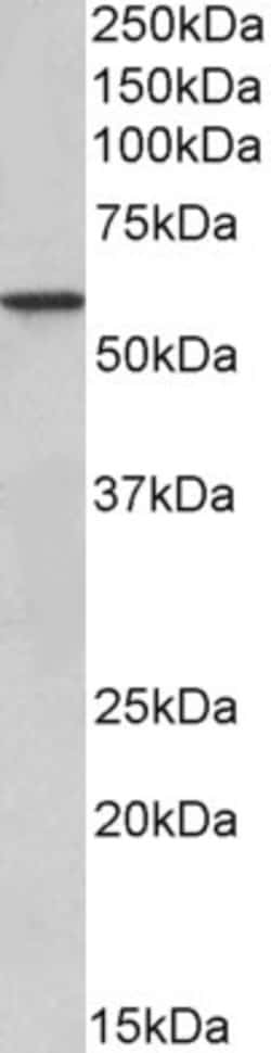 Invitrogen EPHX2 Polyclonal Antibody 100 &mu;g; Unconjugated:Antibodies,
