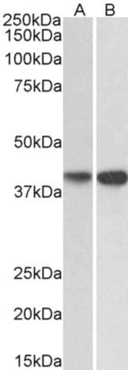 Invitrogen ENDOGL1 Polyclonal Antibody 100 &mu;g; Unconjugated:Antibodies,