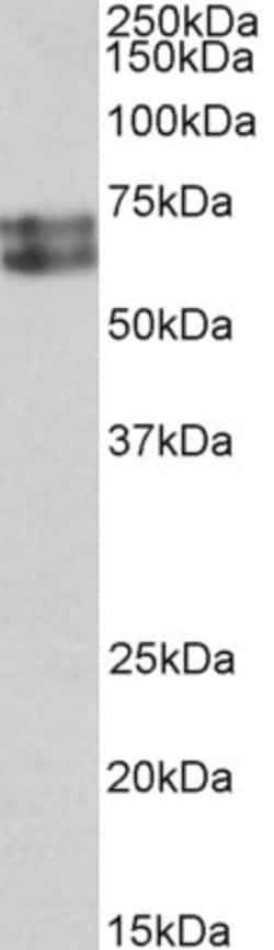 Invitrogen HDC Polyclonal Antibody 100 &mu;g | Buy Online | Invitrogen&trade; | Fisher Scientific