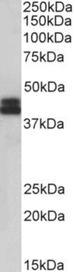 Invitrogen HLA-B Polyclonal Antibody 100 μg; Unconjugated:Antibodies,