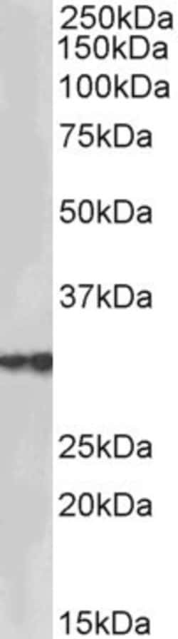 Invitrogen HSD17B3 Polyclonal Antibody 100 μg; Unconjugated:Antibodies,
