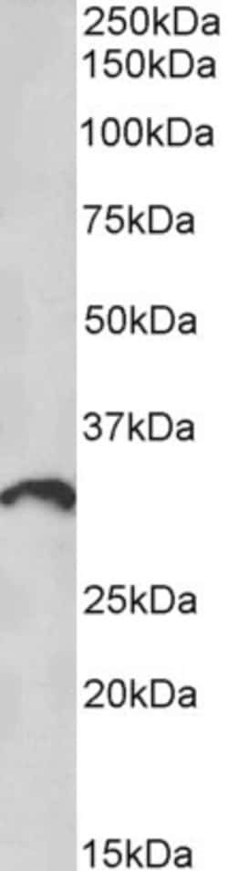 Invitrogen CD275 (B7-H2) Polyclonal Antibody 100 μg; Unconjugated:Antibodies,
