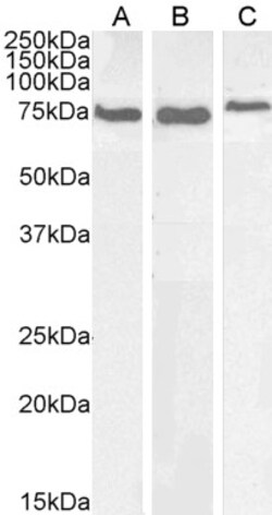 Invitrogen GRP78 Polyclonal Antibody 100 &mu;g | Buy Online | Invitrogen&trade; | Fisher Scientific