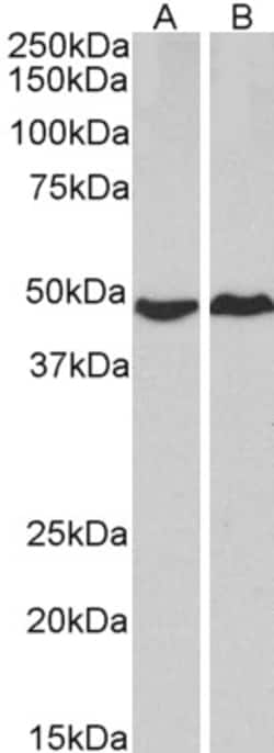 Invitrogen PKA alpha Polyclonal Antibody 100 &mu;g | Buy Online | Invitrogen&trade; | Fisher Scientific