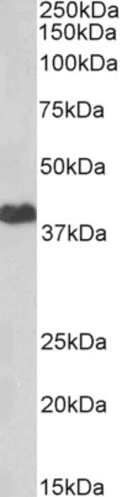 Invitrogen PKA alpha Polyclonal Antibody 100 &mu;g; Unconjugated:Antibodies,