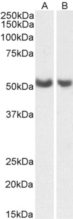 Invitrogen PTGIS Polyclonal Antibody 100 &mu;g; Unconjugated:Antibodies,