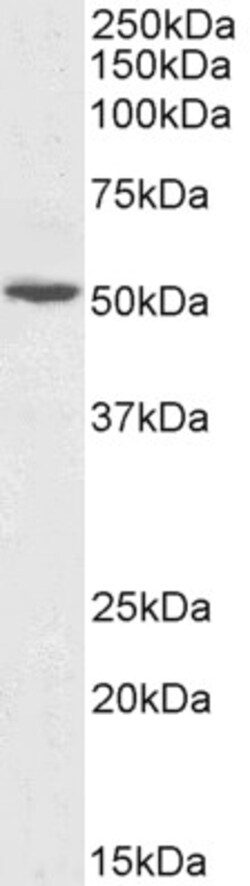 Invitrogen GPT Polyclonal Antibody 100 μg; Unconjugated:Antibodies,
