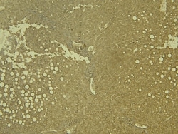 Invitrogen LCAT Polyclonal Antibody 100 μg; Unconjugated:Antibodies,