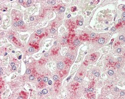 Invitrogen LCAT Polyclonal Antibody 100 μg; Unconjugated:Antibodies,