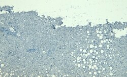 Invitrogen LCAT Polyclonal Antibody 100 μg; Unconjugated:Antibodies,