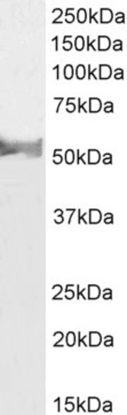 Invitrogen LCAT Polyclonal Antibody 100 μg; Unconjugated:Antibodies,