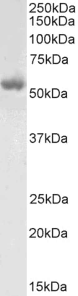 Invitrogen LCAT Polyclonal Antibody 100 &mu;g; Unconjugated:Antibodies,