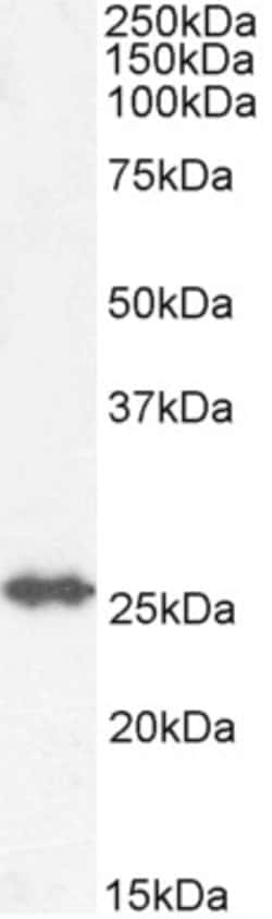 Invitrogen GSTM4 Polyclonal Antibody 100 &mu;g; Unconjugated:Antibodies,