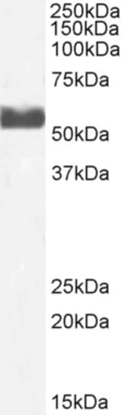 Invitrogen CYP2D6 Polyclonal Antibody 100 &mu;g; Unconjugated:Antibodies,