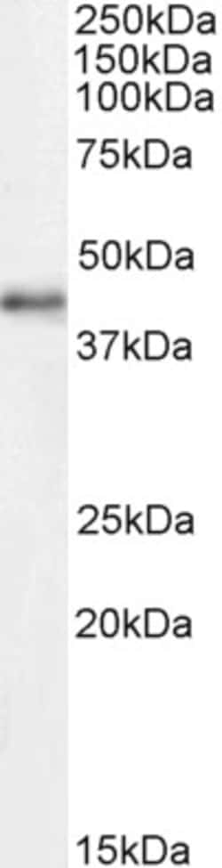 Invitrogen CDK9 Polyclonal Antibody 100 μg; Unconjugated:Antibodies,