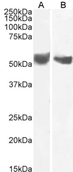 Invitrogen B7-H3 (CD276) Polyclonal Antibody 100 &mu;g | Buy Online | Invitrogen&trade; | Fisher Scientific