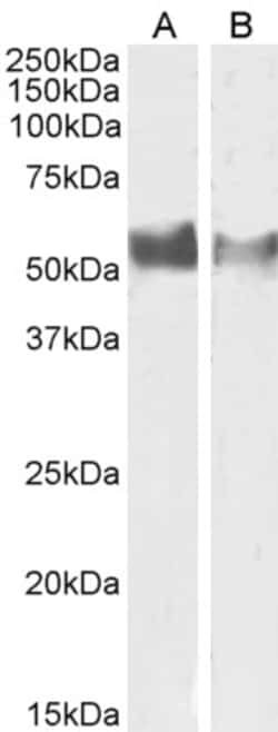 Invitrogen CD223 Polyclonal Antibody 100 &mu;g; Unconjugated:Antibodies,