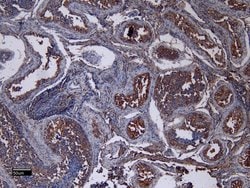 Invitrogen ACE2 Polyclonal Antibody 100 &mu;g; Unconjugated:Antibodies,