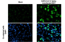 SARS-CoV-2 Spike Protein S2/S2' (strain Wuhan-Hu-1) Polyclonal Antibody,