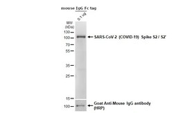 SARS-CoV-2 Spike Protein S2/S2' (strain Wuhan-Hu-1) Polyclonal Antibody,