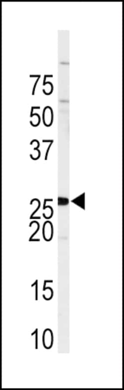 Invitrogen SPRY4 Polyclonal Antibody 400 &mu;L; Unconjugated:Antibodies,