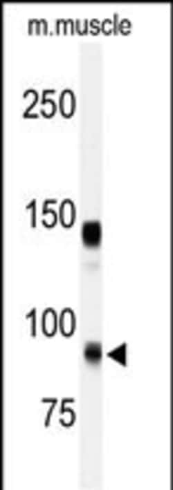 Invitrogen ADAMTS5 Polyclonal Antibody 400 &mu;L; Unconjugated:Antibodies,