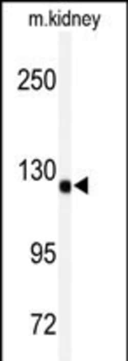 Invitrogen ADAMTS19 Polyclonal Antibody 400 &mu;L; Unconjugated:Antibodies,