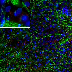 Invitrogen Adenylate Cyclase 3 Polyclonal Antibody 100 &mu;L; Unconjugated:Antibodies,