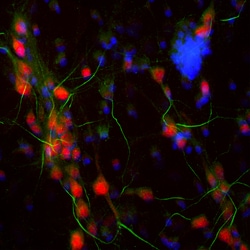 Invitrogen Ankyrin G Polyclonal Antibody 100 &mu;L; Unconjugated:Antibodies,