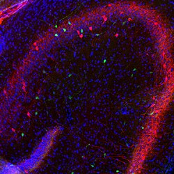 Invitrogen Calretinin Polyclonal Antibody:Antibodies:Primary Antibodies