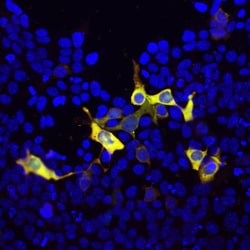 Invitrogen Cas9 Polyclonal Antibody:Antibodies:Primary Antibodies