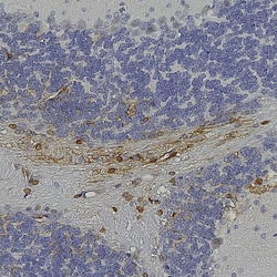 Invitrogen GFP Polyclonal Antibody 100 &mu;L; Unconjugated:Antibodies,