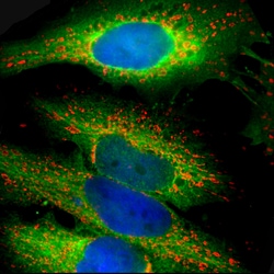 Invitrogen HSP27 Polyclonal Antibody:Antibodies:Primary Antibodies