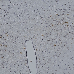 Invitrogen mCherry Polyclonal Antibody 100 &mu;L; Unconjugated:Antibodies,