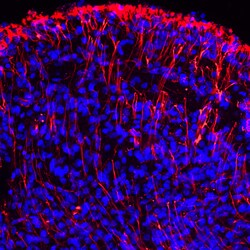 Invitrogen Nestin Polyclonal Antibody:Antibodies:Primary Antibodies