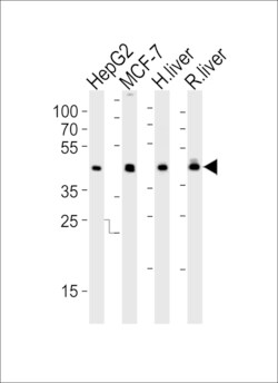 Invitrogen IDH1 Polyclonal Antibody 400 &mu;L | Buy Online | Invitrogen&trade; | Fisher Scientific