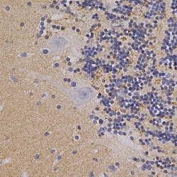 Invitrogen alpha Synuclein Polyclonal Antibody:Antibodies:Primary Antibodies
