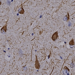 Invitrogen Tau Polyclonal Antibody 500 &mu;L; Unconjugated:Antibodies,