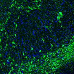 Invitrogen Tyrosine Hydroxylase Polyclonal Antibody:Antibodies:Primary