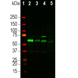 Invitrogen Tyrosine Hydroxylase Polyclonal Antibody:Antibodies:Primary
