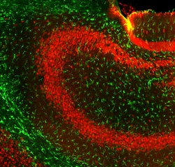 Invitrogen GFAP Polyclonal Antibody:Antibodies:Primary Antibodies