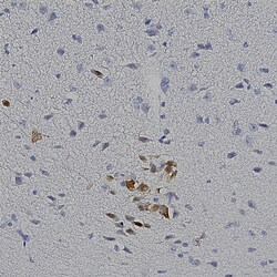 Invitrogen mCherry Polyclonal Antibody 100 &mu;L; Unconjugated:Antibodies,