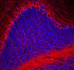 Invitrogen NF-H Polyclonal Antibody:Antibodies:Primary Antibodies