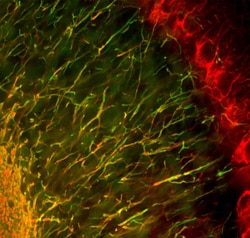 Invitrogen NF-H Polyclonal Antibody:Antibodies:Primary Antibodies