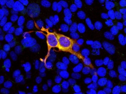Invitrogen Cas9 Polyclonal Antibody:Antibodies:Primary Antibodies